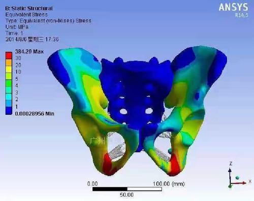 医学三维图像(Mimics)及生物力学(ANSYS) 建模仿真技术培训班